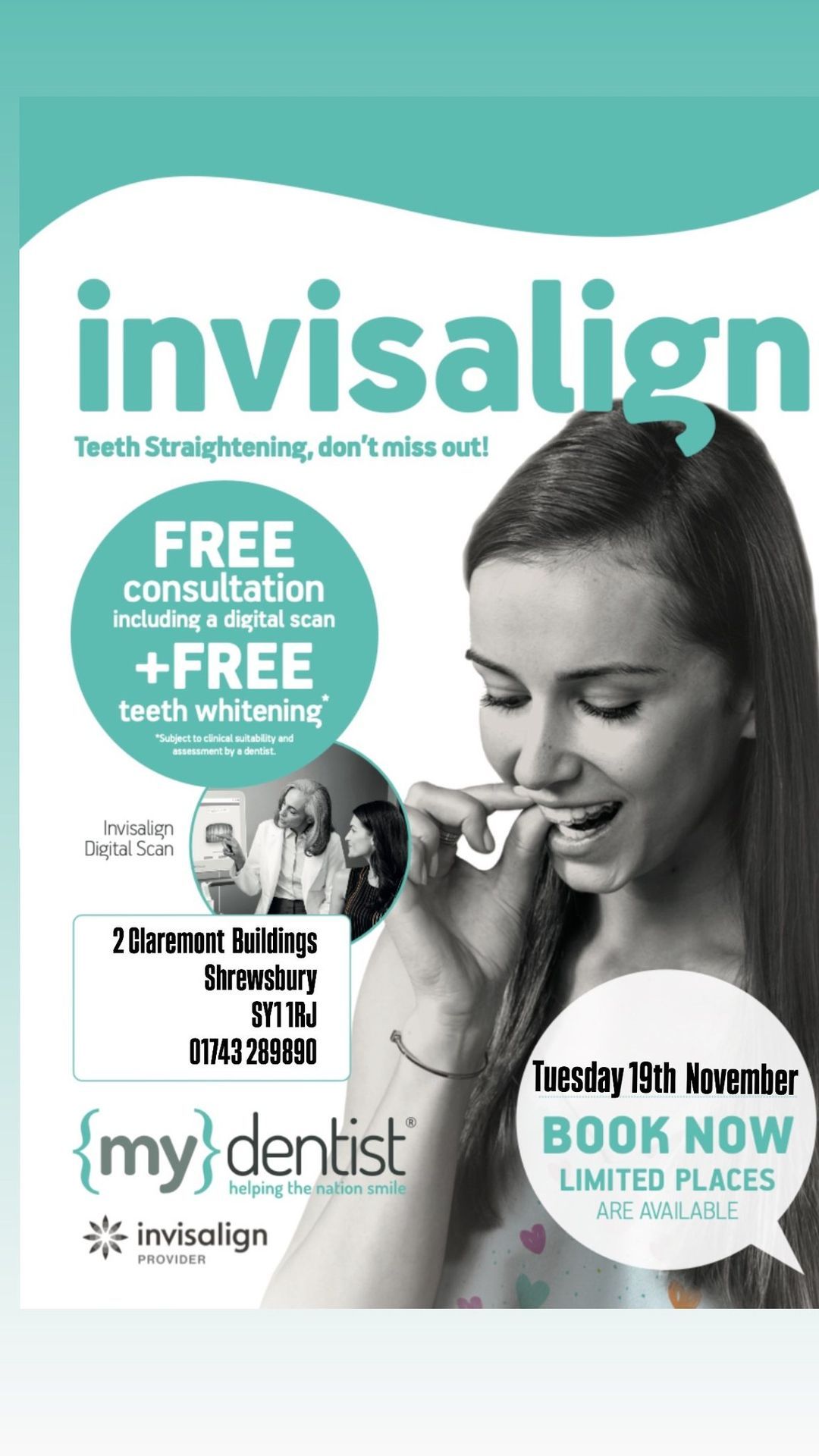 Invisalign Event