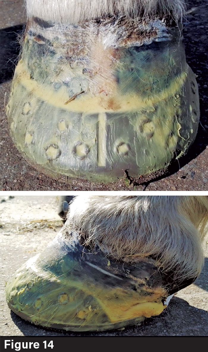 Keratoma