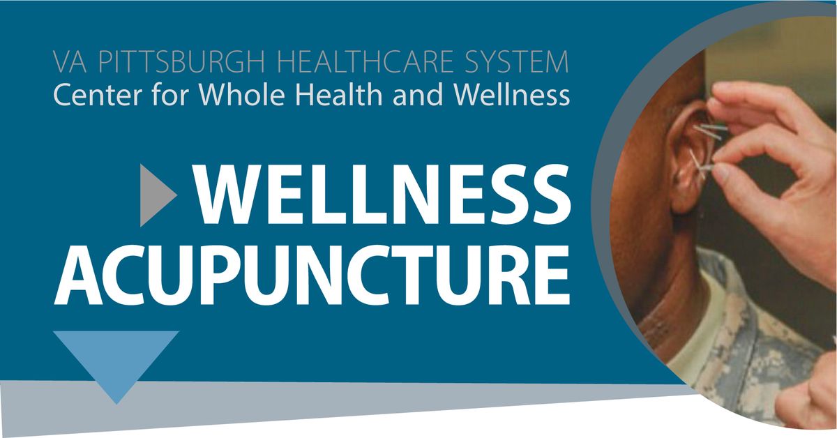 Wellness acupuncture\/acupressure patient volunteers are needed