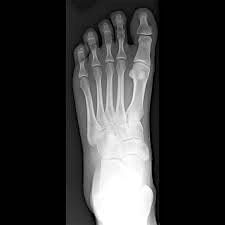Imaging of the Ankle & Foot (Session 1)