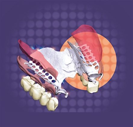 Next-Gen Digital RPD Workflow Workshop