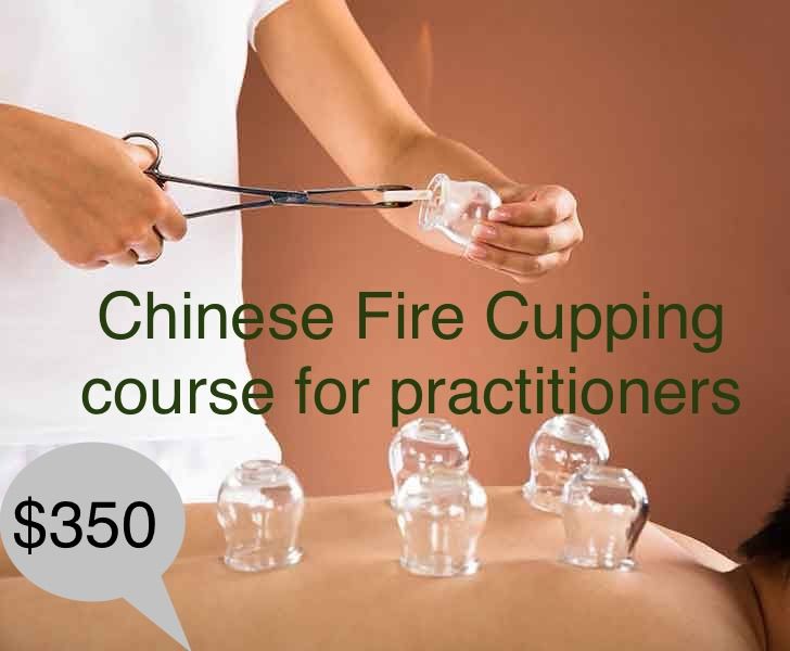 Chinese Fire Cupping training