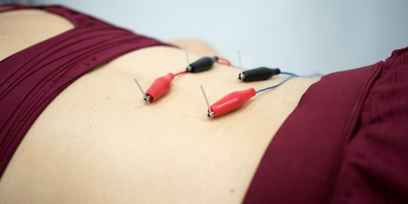 Dry Needling & Pelvic Health: Foundational Concepts and Techniques (3 day in-person course) 