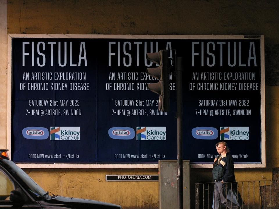 FISTULA - ART EXHIBITION