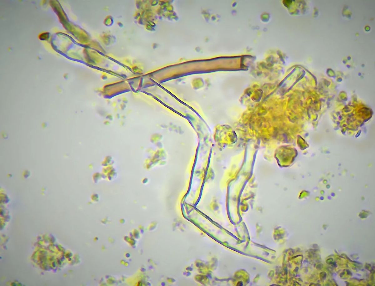 Inside the Soil Food Web