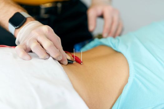 Functional Dry Needling\u00ae Level 2
