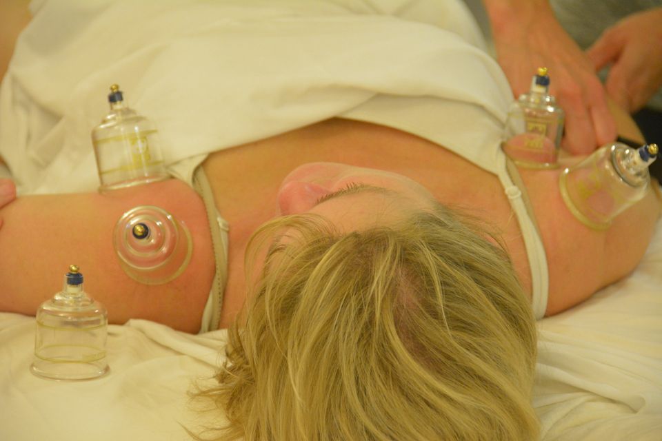 TCM Cupping\/Gua Sha Workshop in University Place