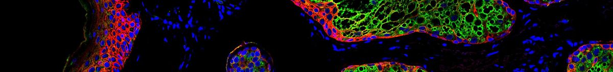 Proteintech \u2013 solutions focused antibodies and immunoassays