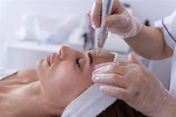 Microneedling Course