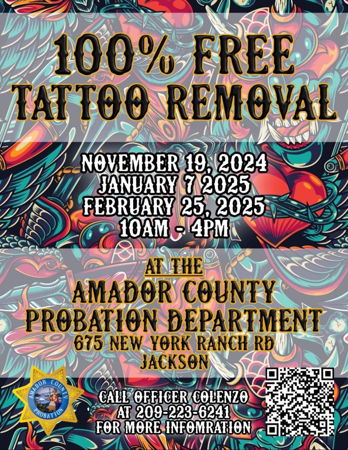 February 25 Tattoo Removal Event