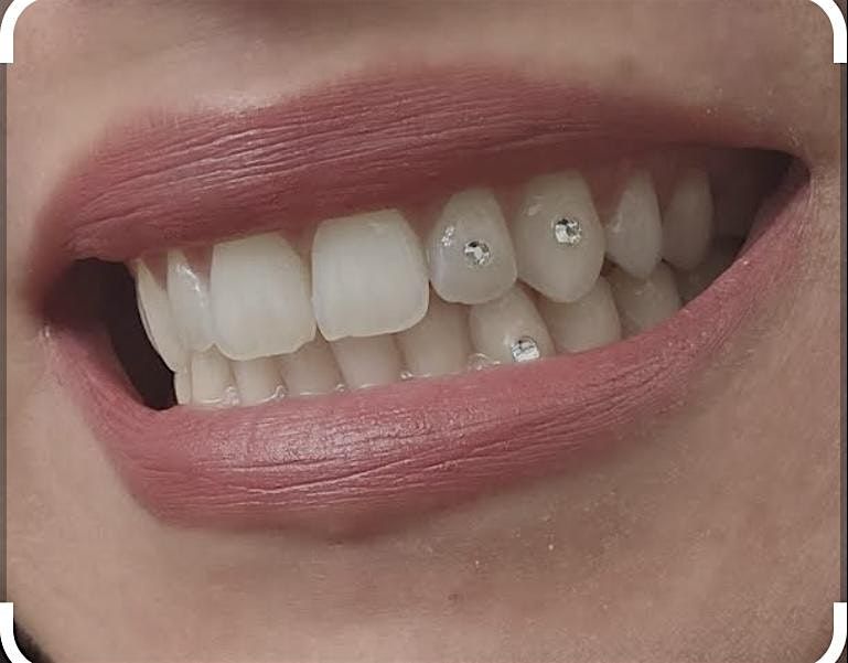 Tooth gem instructional workshop