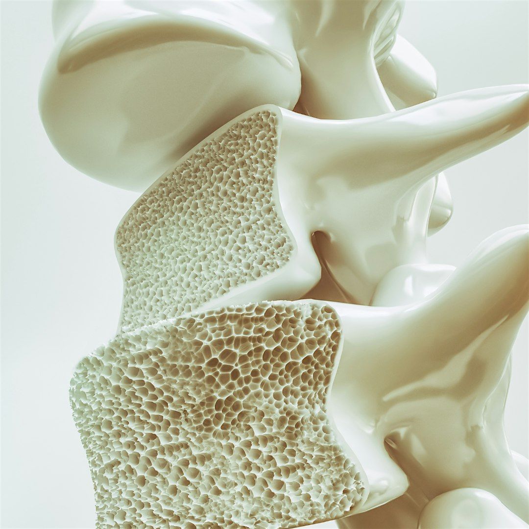 HOT TOPICS: Osteoporosis - prevention and treatment