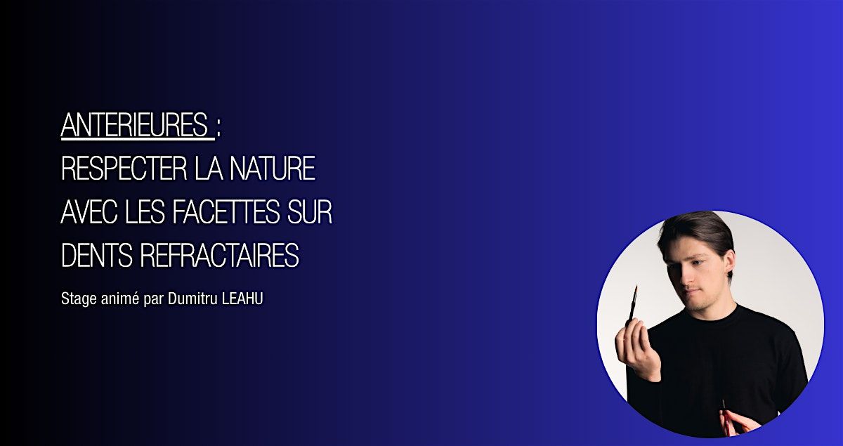 Ant\u00e9rieures : respecter la nature avec les facettes sur dents r\u00e9fractaires