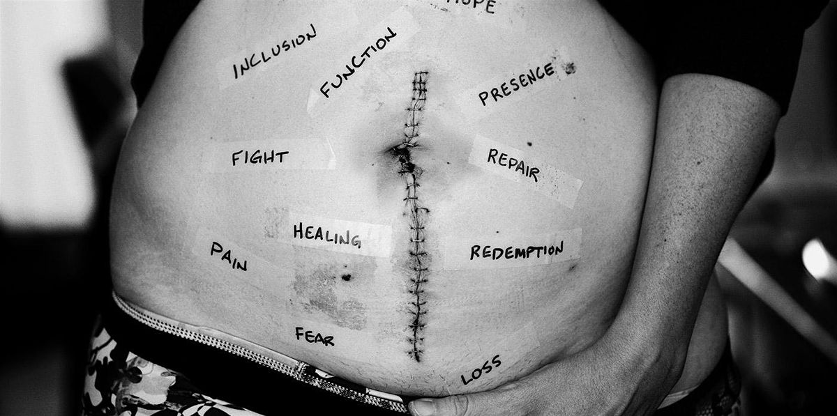 Fascial Approaches: Scar Tissue Adhesion Workshop
