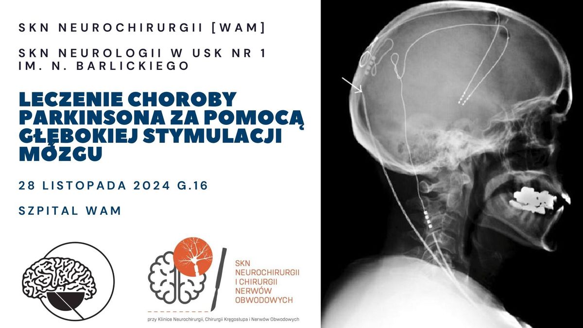 Spotkanie SKN\u00f3w Neurochirurgii i Neurologii - Choroba Parkinsona