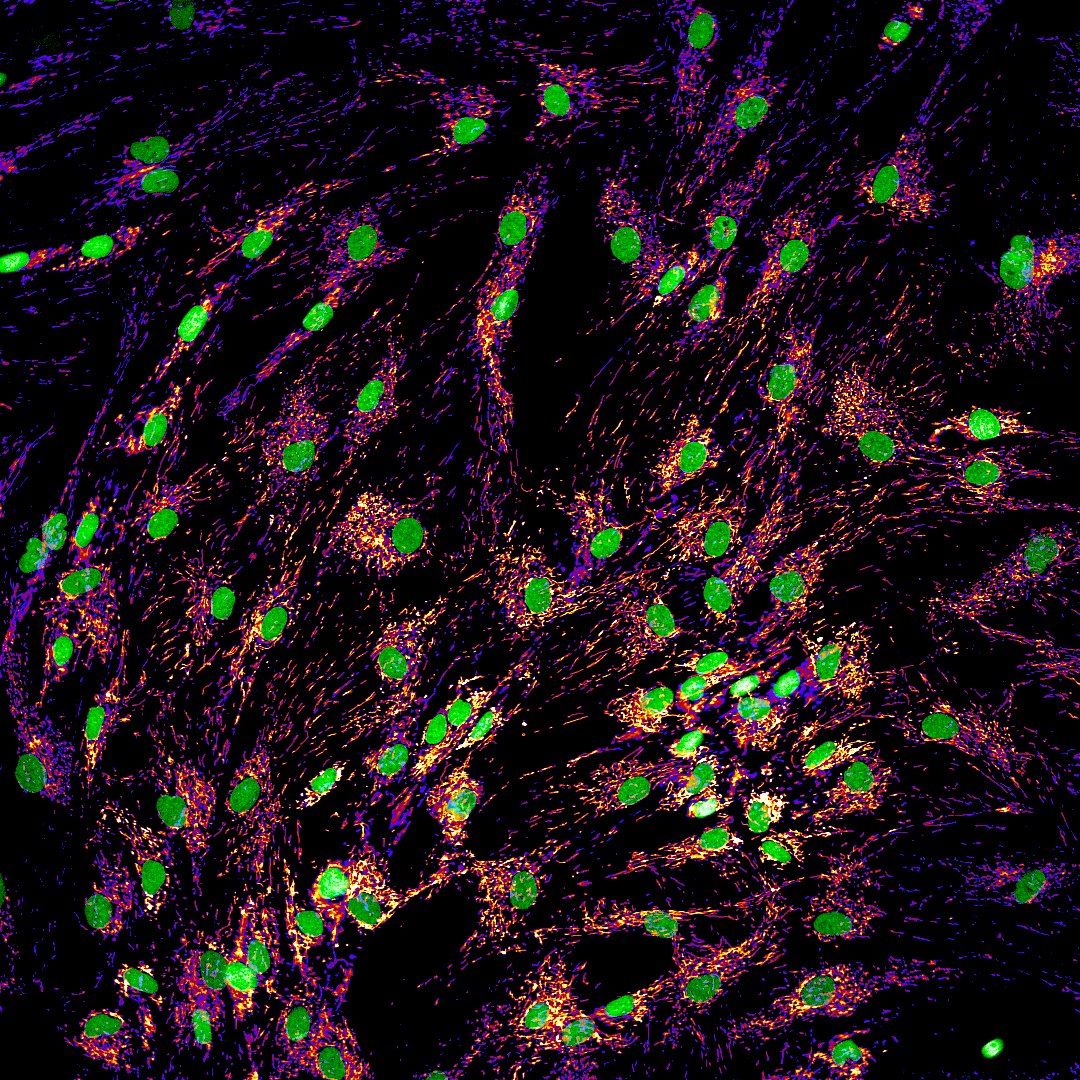 Metabolic Interfaces: Mitochondria, Microbes, and the Microbiome