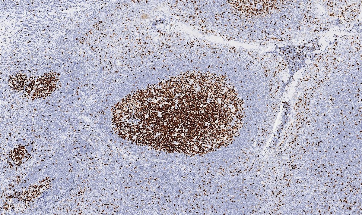 The Immunohistochemistry Network: South West Regional Meeting