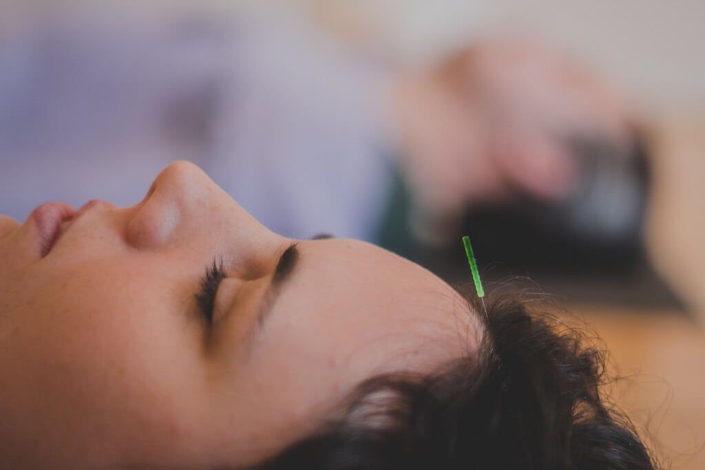 seasonal serenity: acupuncture + yin yoga