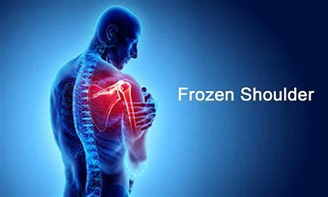 Working with Frozen Shoulder Patients-Jimmy Gialelis