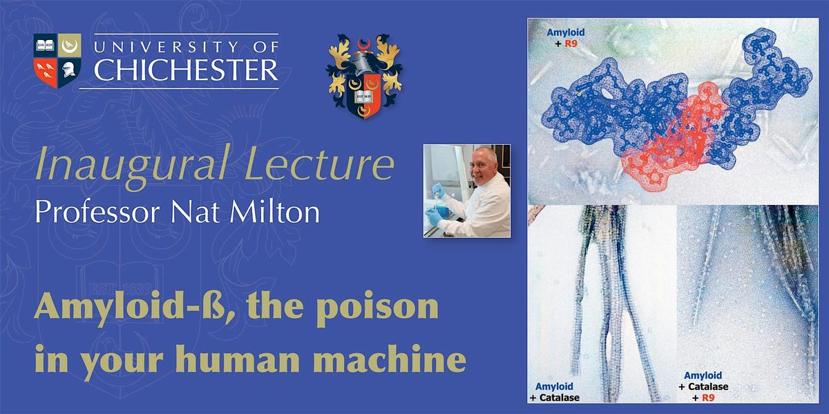 Amyloid-\u00df, the poison in your human machine