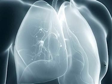 Living Well with Lung Cancer: Patient & Family Education Seminar