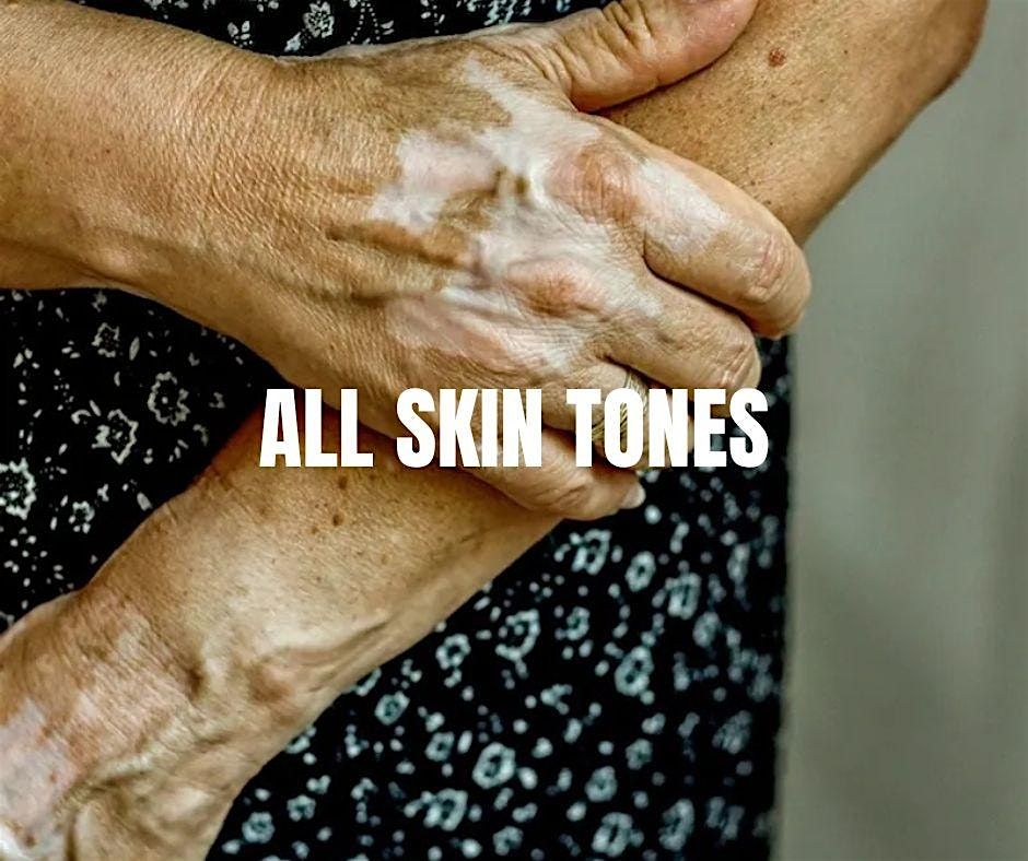 All Skin Tones Conference  2025