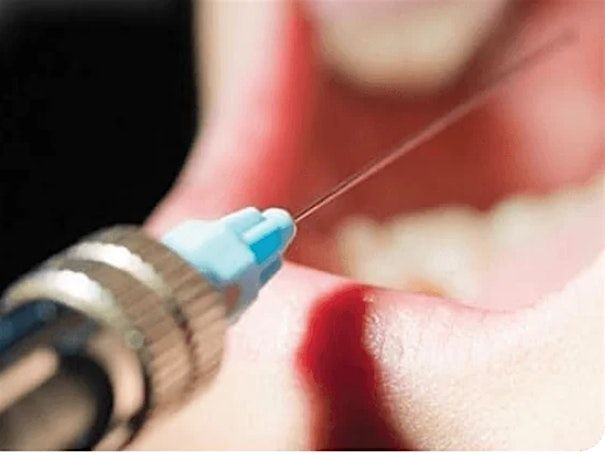 Comprehensive Review and Preparation of Local Anesthetic Administration!