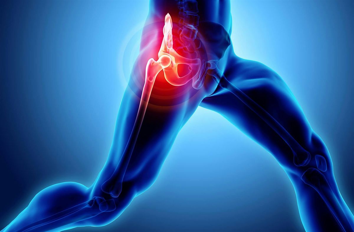 Free CPD Event- Lateral Hip Pain