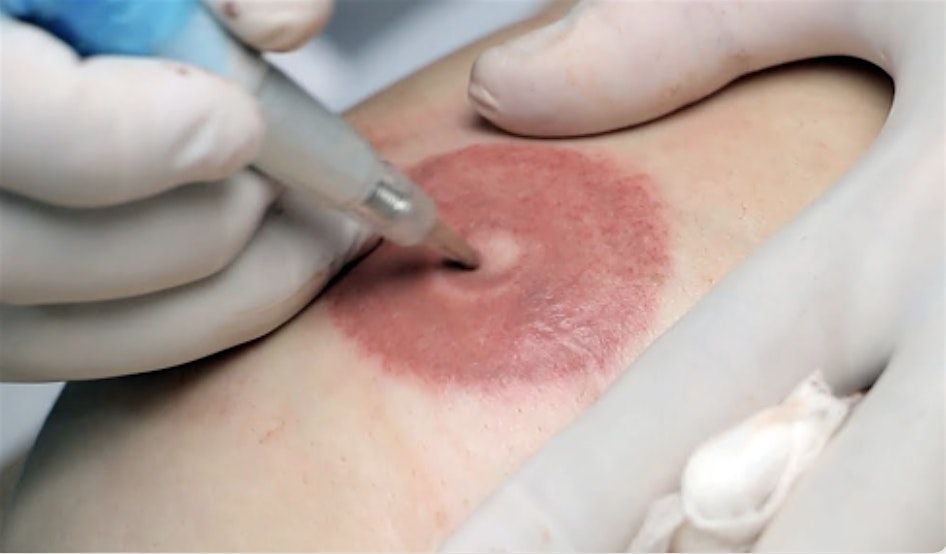 3D Nipple and Areola Tattoo Training