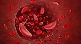 Voices of Hope: A Sickle Cell Gathering for Healing and Health Equity