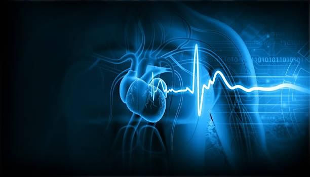 ECG CPD: STEMI mimics in Northallerton