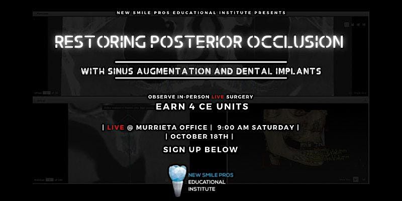 Restoring Posterior Occlusion with Sinus Augmentation and Dental Implants