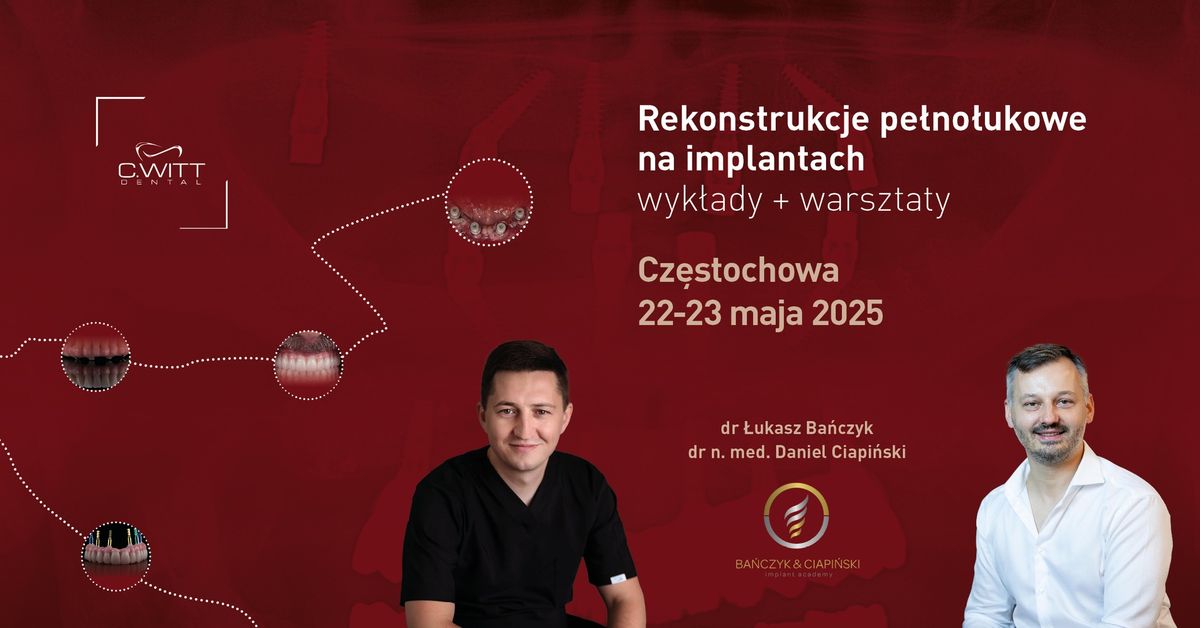 Rekonstrukcje pe\u0142no\u0142ukowe na implantach