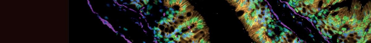 Immunofluorescence Workshop: Make your data glow!