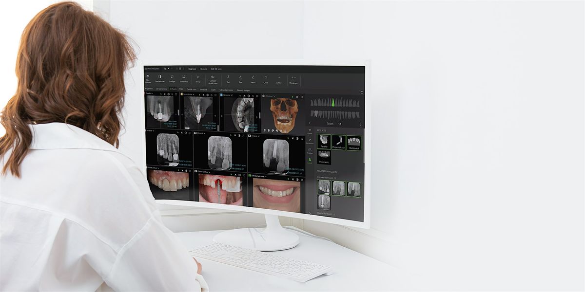 Digital Implant Planning  with DTX Studio