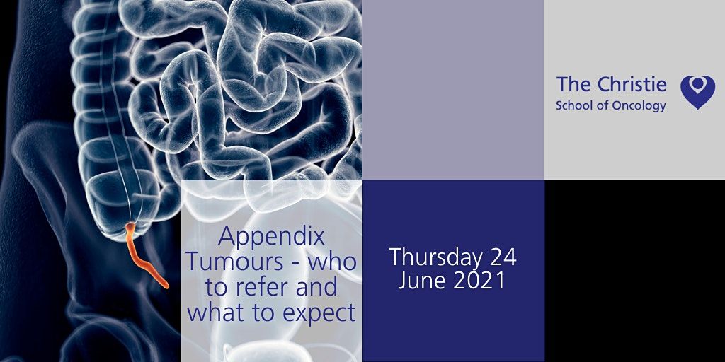 Appendix Tumours: who to refer and what to expect