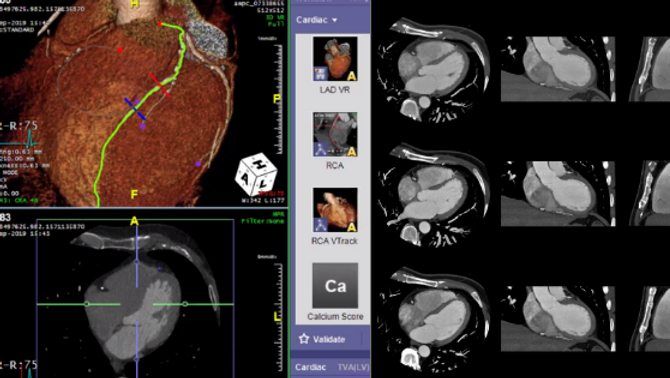 Cardiac CT Level 1\/2 Course