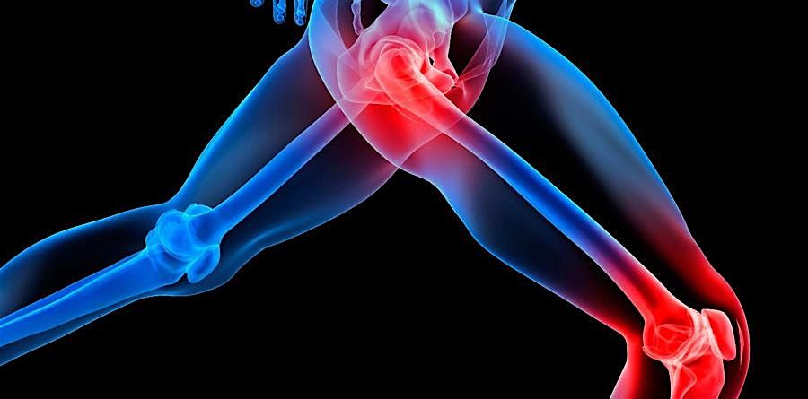 Understanding Hip and Knee Arthritis