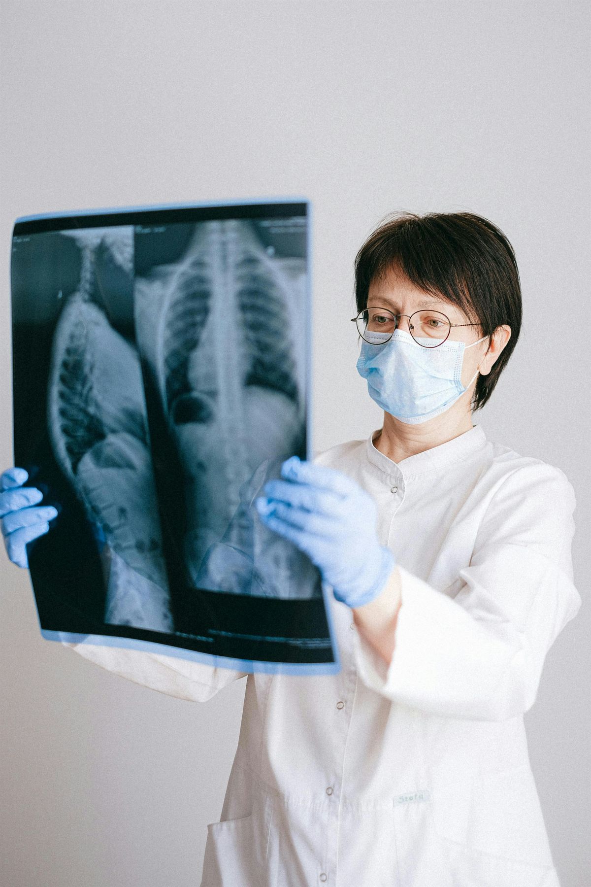 Innovating Lung Cancer Care Through Nanotechnology