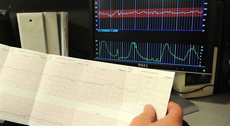 Fundamentals of Fetal Monitoring