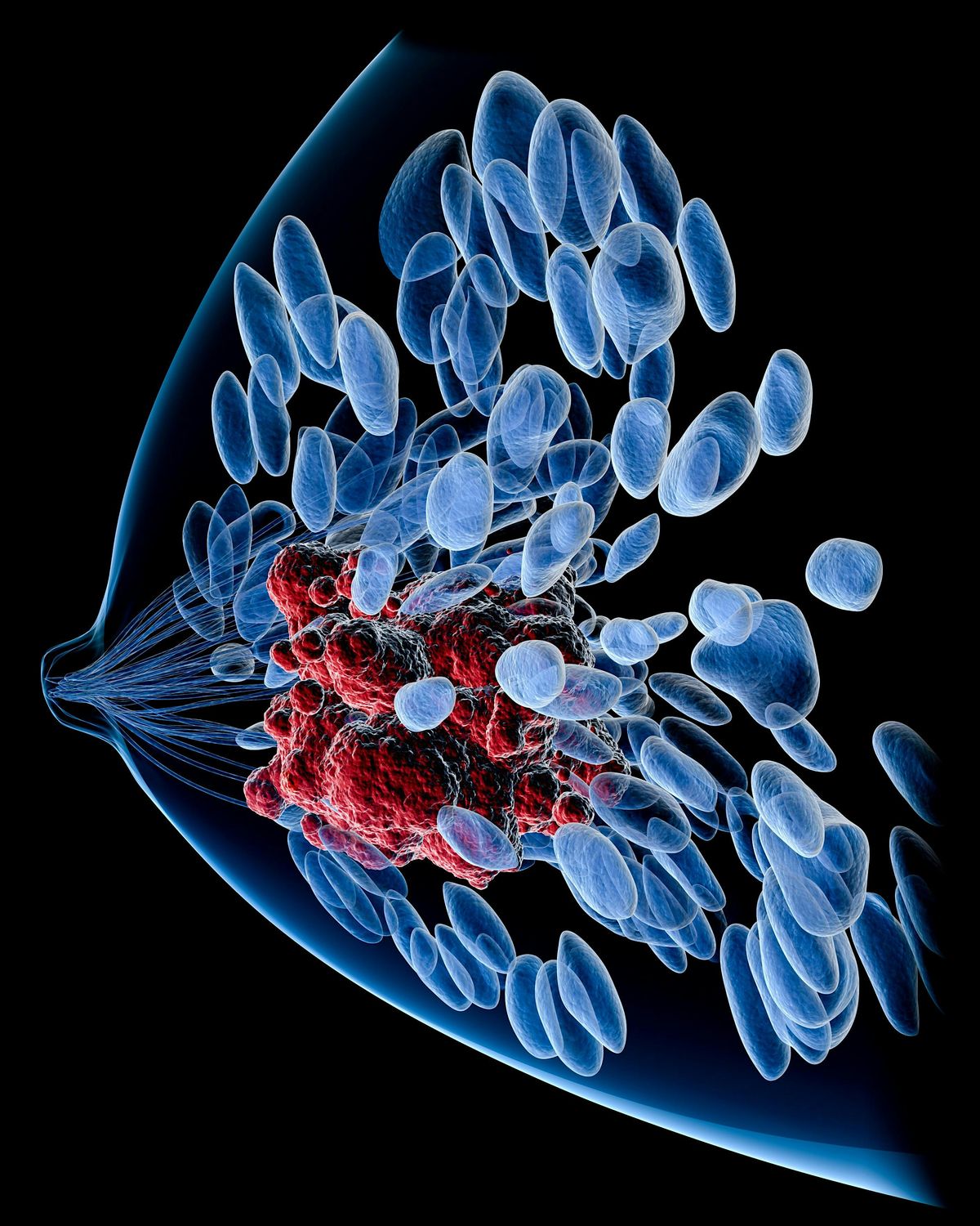 Metastatic Breast Cancer Study Day