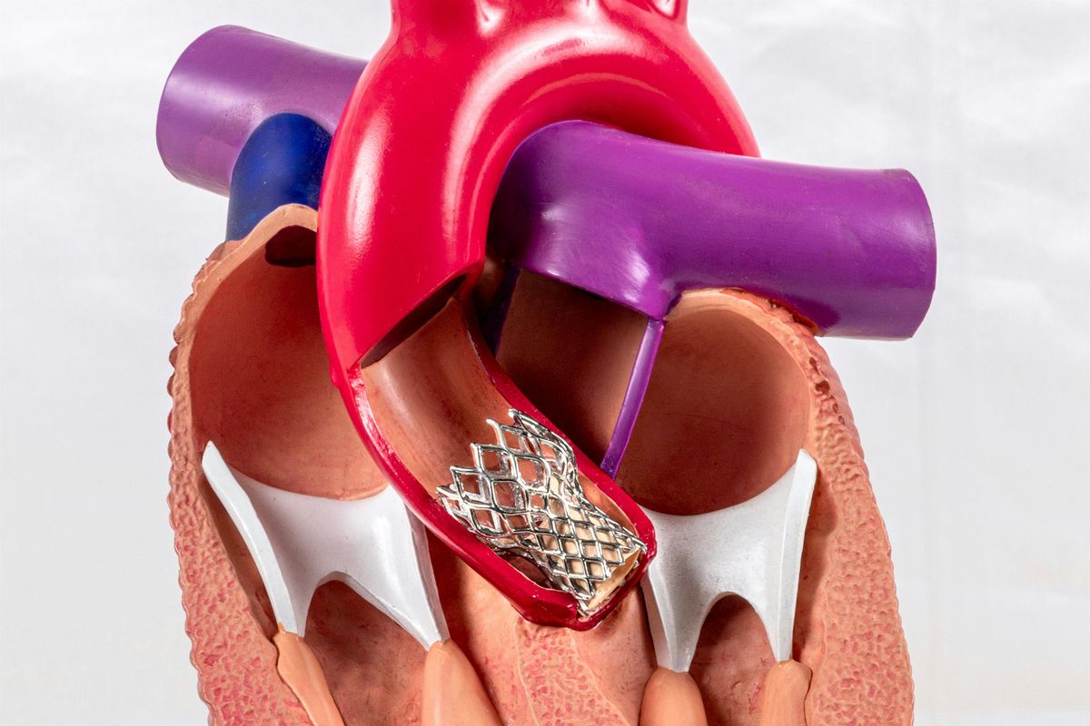 TAVI Planning: A Beginner and Advanced Hands-On Imaging Workshop