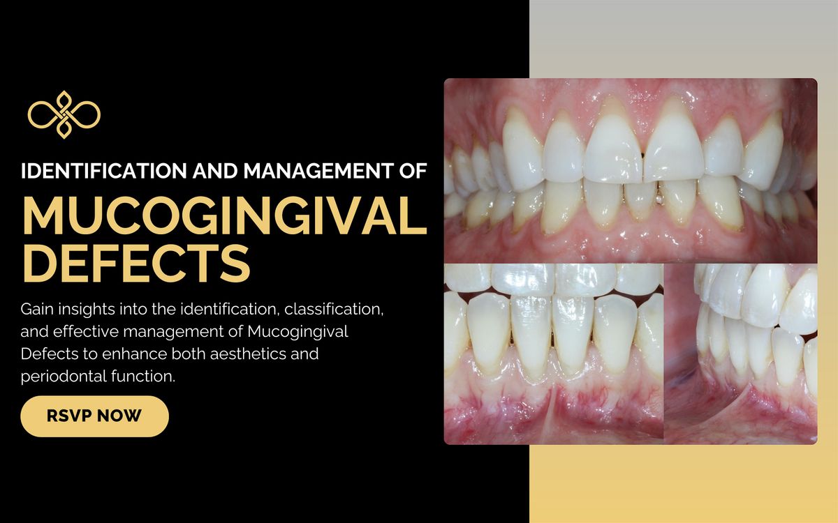 Identification and Management of Mucogingival Defects