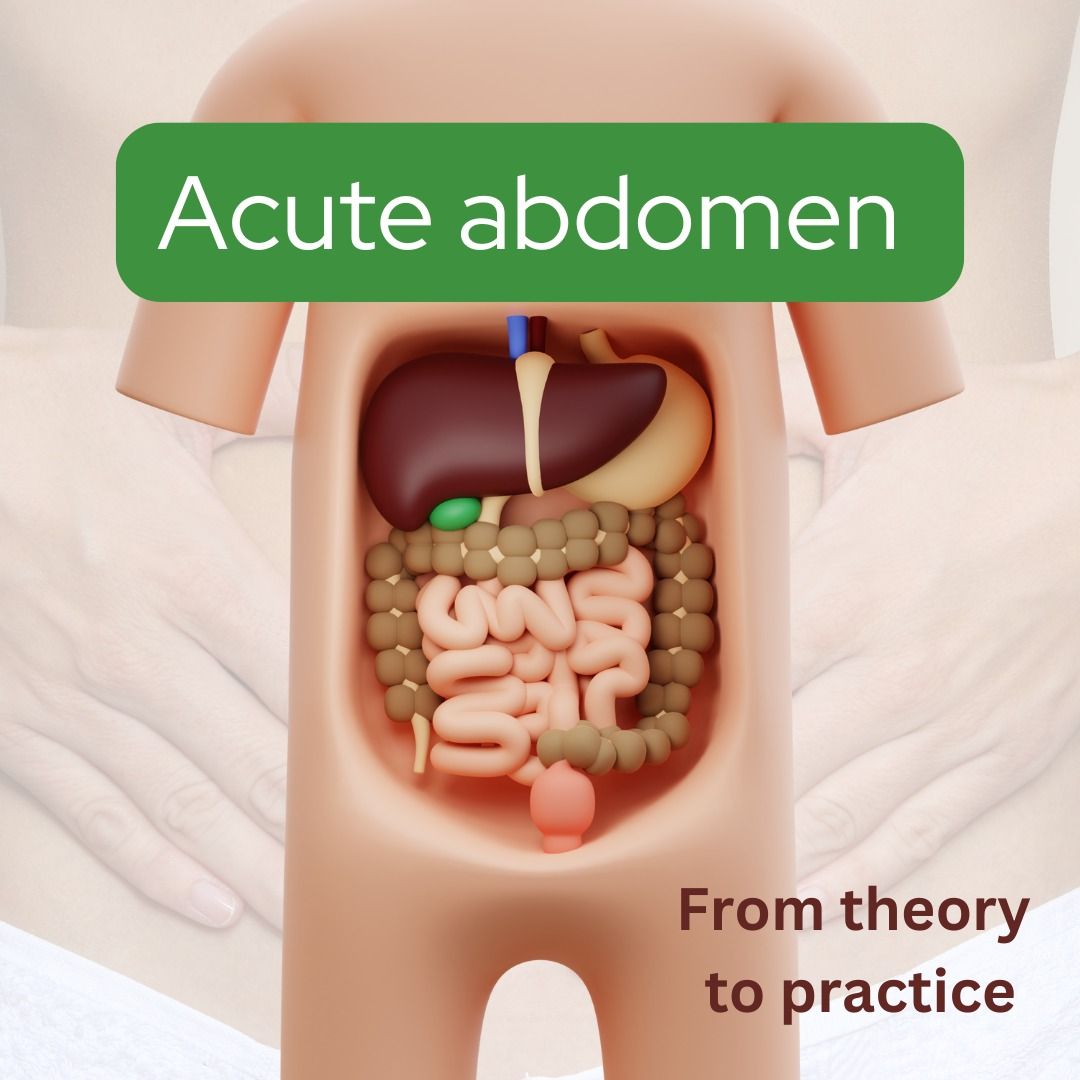 Acute abdomen -  Practical Approaches