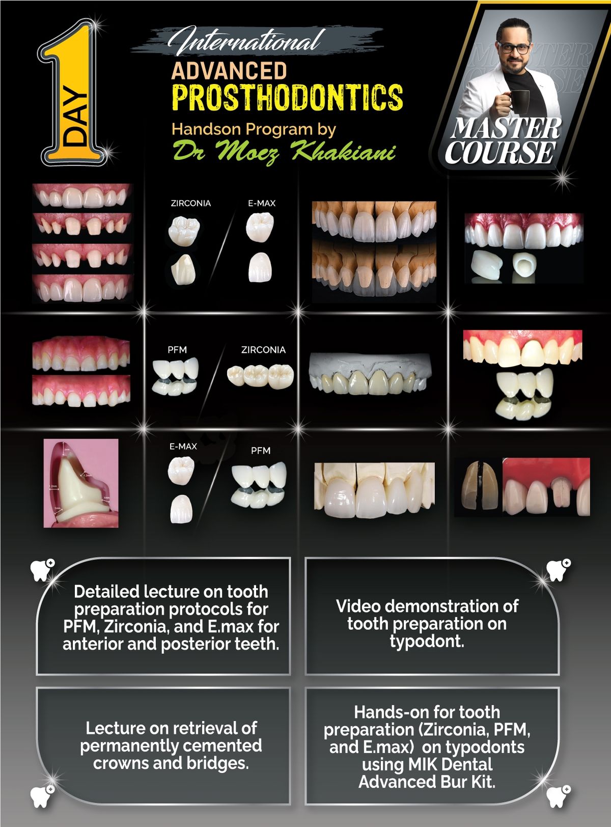 Upgrading Your Dentistry