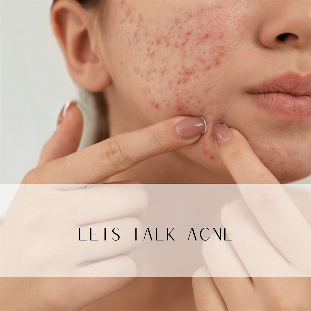 Unmasking Acne: Skin, Hormones & Healing