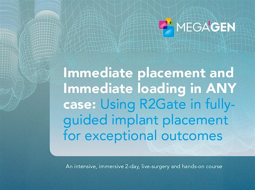 Immediate placement and immediate loading in ANY case using R2Gate