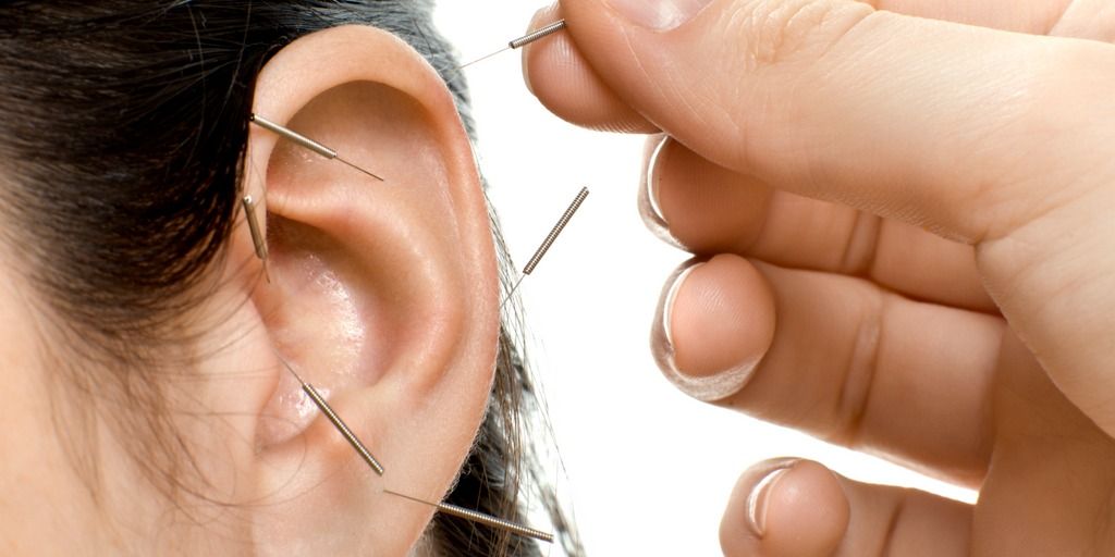 Community Auricular Acupuncture with Orit