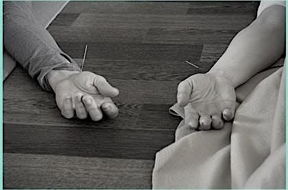 AcuYin - Yin Yoga & Acupuncture