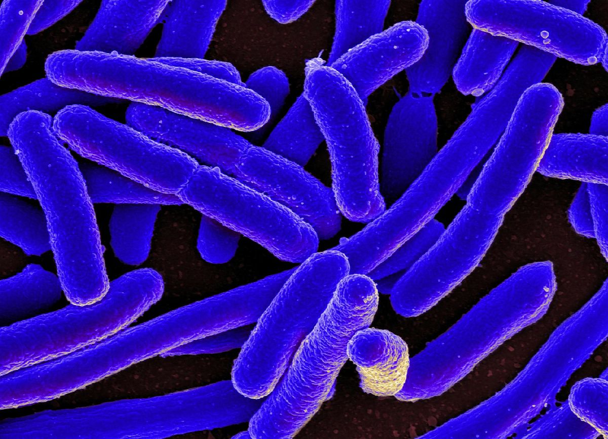 Fall 2025 CD 303:  Outbreak Investigation Essentials